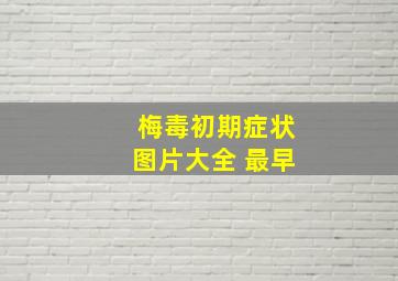 梅毒初期症状图片大全 最早